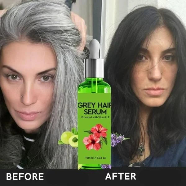 Grey Hair Serum – Hair Care Serum for Grey Hair & Healthy-Looking Hair